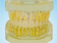 A12 REMOVABLE STANDARD MODEL