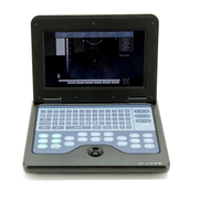 B-Ultrasound Diagnostic System 
