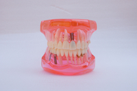HST-C15 RESTORATION WITH IMPLANT(CLEAR, BLUE ,ORANGE, PINK,YELLOW CAN BE CHOOSED)