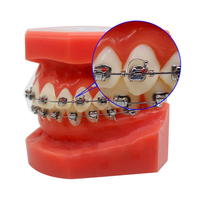 Dental Orthodontic Brackets Teeth Torque Springs