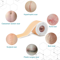 Silicone Scar Sheet Silicone Tape Roll 