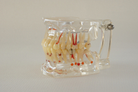 HST-C1 PATHOLOGY MODEL WITH HALF IMPLANT