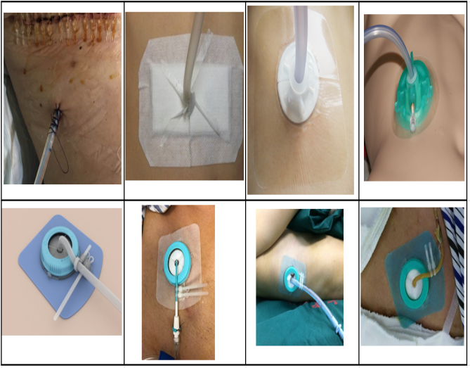 固定器8图对照10.27